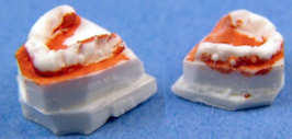 (image for) Denture try-ins