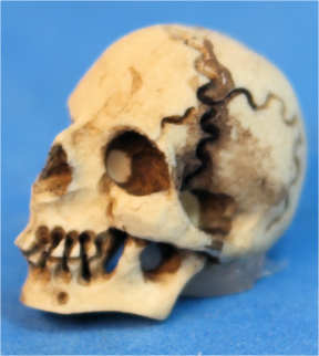 Human skull - Click Image to Close