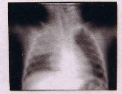 (image for) X-ray - human