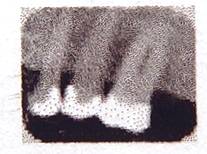 (image for) X-ray teeth